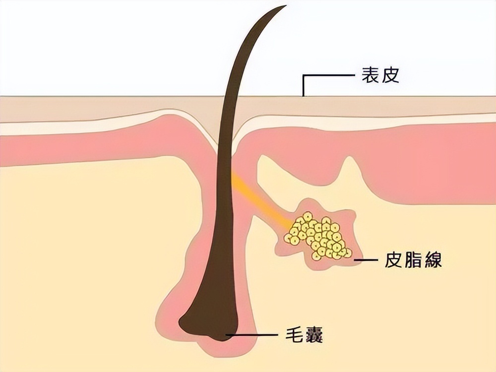 刺激性接触性皮炎_以油养肤的危害_以油养肤教程